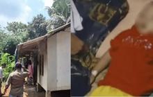 Kisah Raya, Bocah 3 Tahun Ortu ODGJ Meninggal Akibat Tubuh dan Otaknya Dipenuhi Cacing Gelang