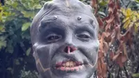 Demi Jadi Black Alien, Pria Ini Nekat Operasi Potong Hidung dan Bibir