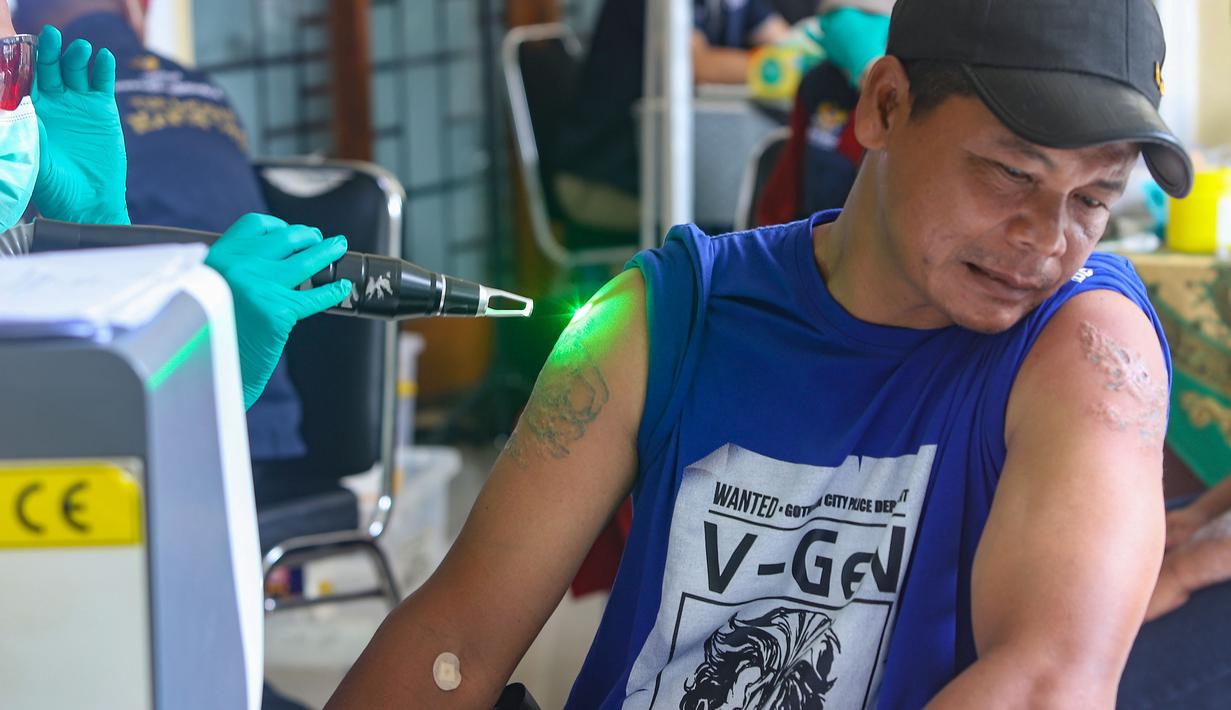 Selain memberikan layanan, Baznas/Bazis DKI Jakarta mengingatkan masyarakat agar lebih bijak sebelum memutuskan memasang tato. Tampak dalam foto, petugas melakukan proses hapus tato pada tubuh peserta di Masjid Sunda Kelapa, Jakarta, Selasa (24/2/2026). (merdeka.com/Arie Basuki)