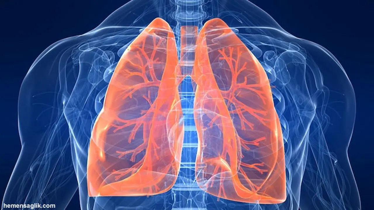pneumonia130719b.jpg