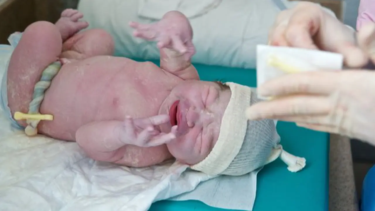 Potong Tali Pusar Bayi Tunggu 2 Menit Biar Tahan Penyakit