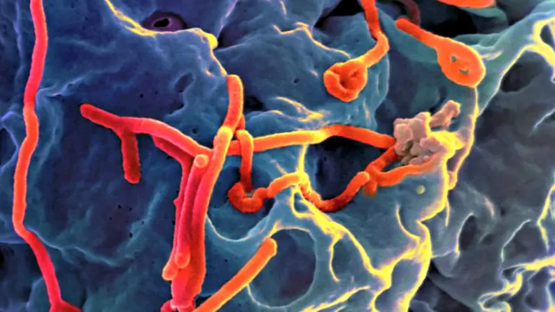 Oops, Hubungan Seksual Juga Bisa Menularkan Ebola