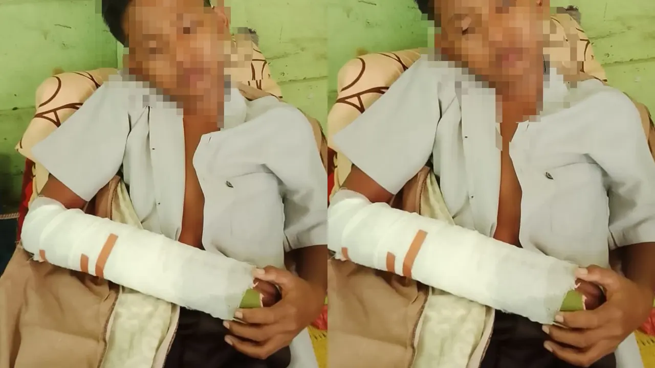 Bukan Dibully, Ini Penyebab 2 Siswa SMP di Tulang Bawang Berkelahi hingga Patah Tangan