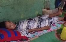 Cerita Miris Warga Bekasi Lumpuh Usai Operasi Caesar, Hasil Pemeriksaan Ada Penyakit Ini