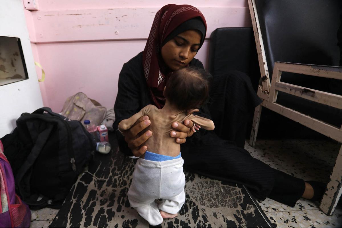 FOTO: Tubuh Kecil yang Lapar, Potret Pedih Bayi Gaza di Tengah Ancaman Kelaparan Massal