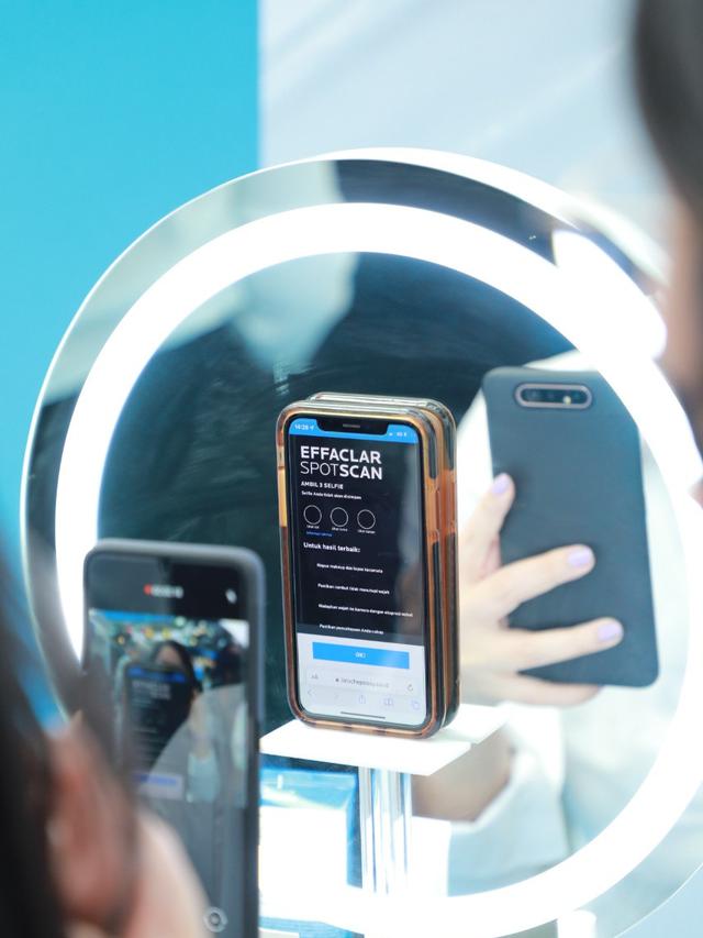 Analisa Kulit Berjerawat Berbasis AI