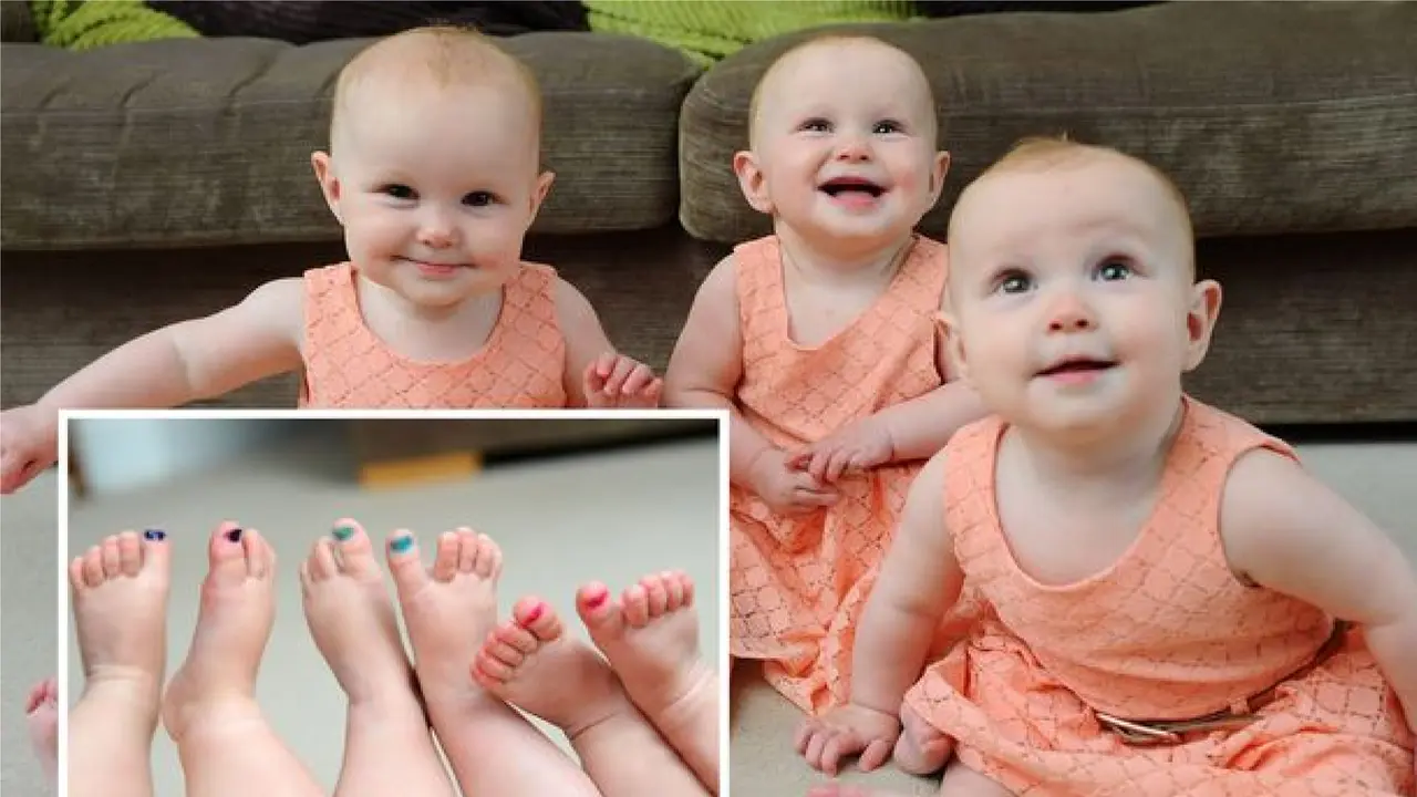 Kuku Bayi Kembar 3 Ini Dicat karena Berwajah Mirip