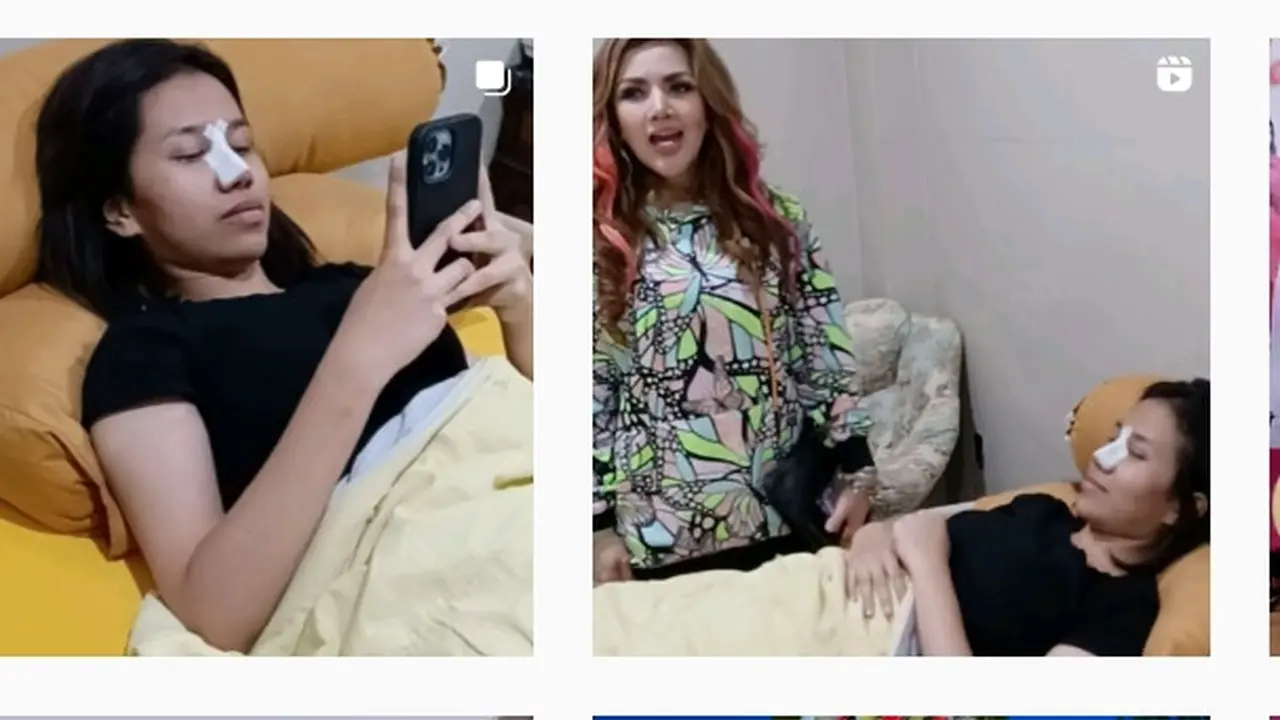 Mayang adik Vanessa Angel disebut habis operasi plastik pada bagian hidung (Foto IG dodysoedrajat_1)