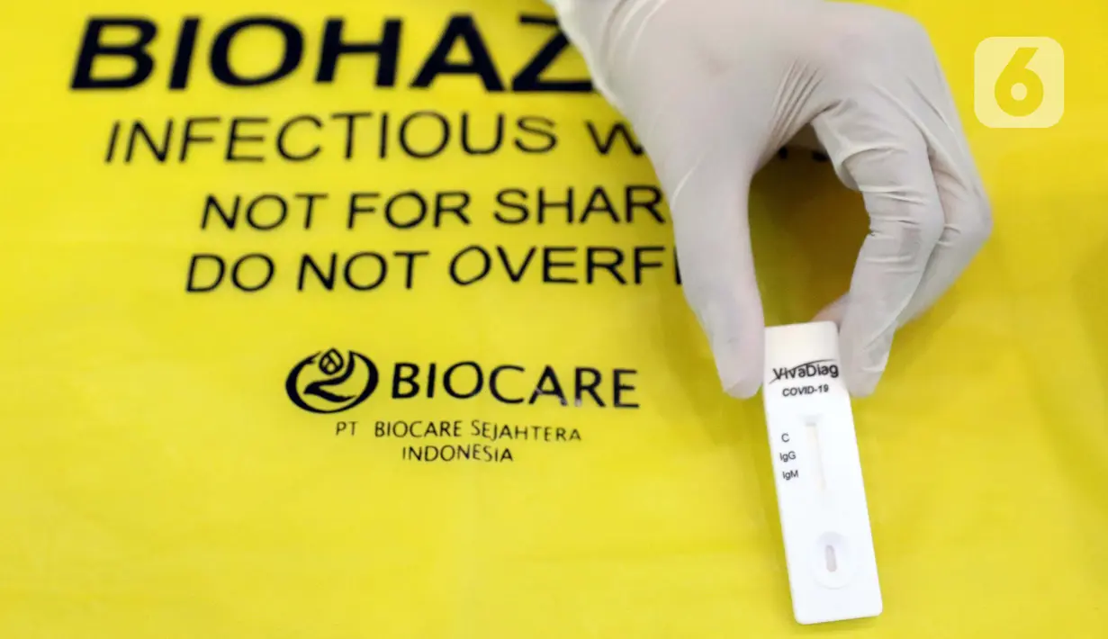 Petugas medis menunjukkan alat Rapid Test COVID-19 di DPP Partai Golkar, Jakarta, Rabu (8/4/2020). Rapid test dilakukan untuk memeriksa virus menggunakan antibodi IgG dan IgM yang ada di dalam darah, antibodi akan terbentuk di tubuh saat mengalami infeksi virus. (Liputan6.com/Helmi Fithriansyah)