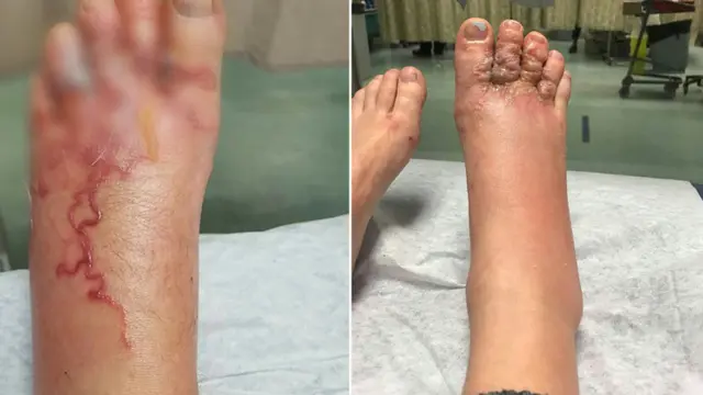 Selain Membengkak Kaki Zytner Dipenuhi Benjolan