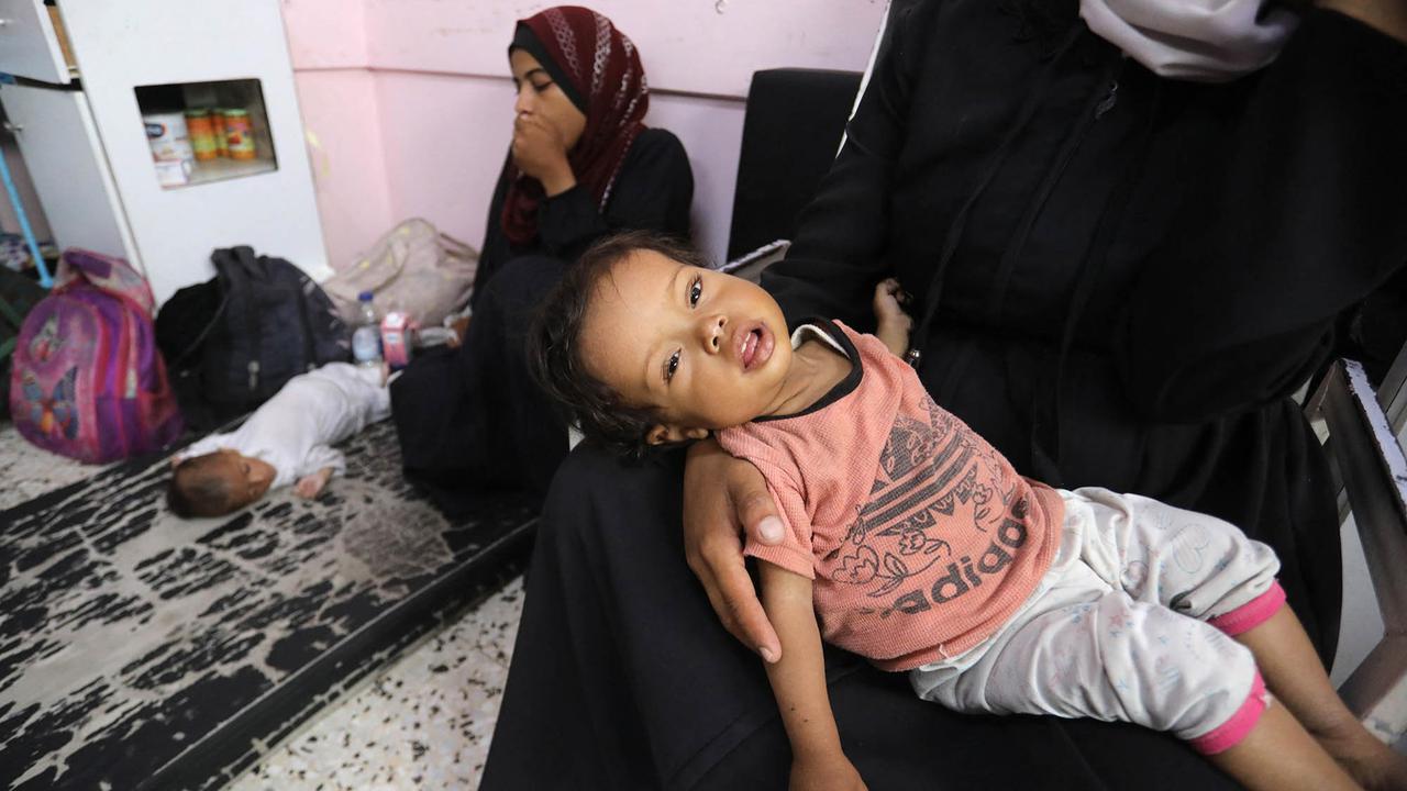 FOTO: Tubuh Kecil yang Lapar, Potret Pedih Bayi Gaza di Tengah Ancaman Kelaparan Massal