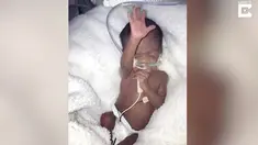 Sebuah rekaman menujukkan saat bayi permatur baru lahir dan menyapa sang Ibunda.
