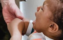 Penyebab Hiperaktif ADHD yang Bisa Diderita Anak, Waspadai Gejala Sejak Dini