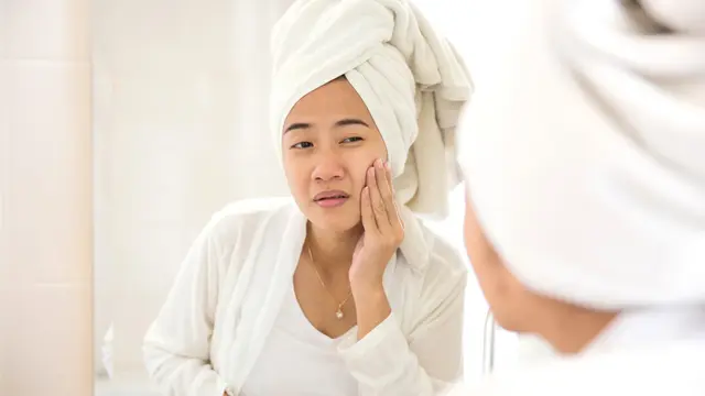 Jangan Lakukan 4 Hal Ini Jika Muka sedang Berjerawat, Akibatnya Bisa Fatal Lho