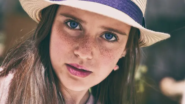 ilustrasi freckles/pixabay