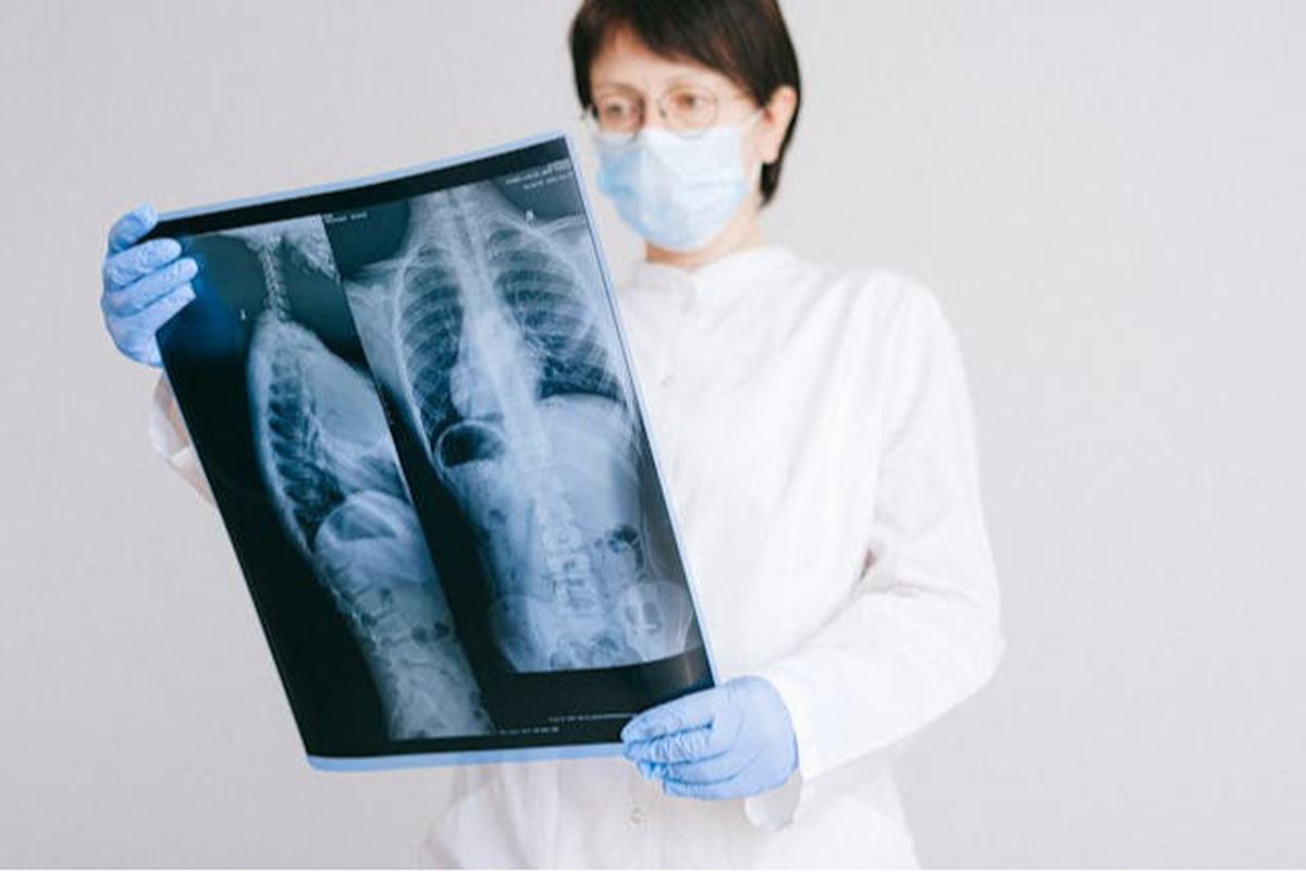 CT Scan atau MRI? Kenali Perbedaan dan Kapan Harus Digunakan