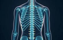 Apa Itu Stenosis Tulang Belakang, Penyebab, dan Cara Penanganannya