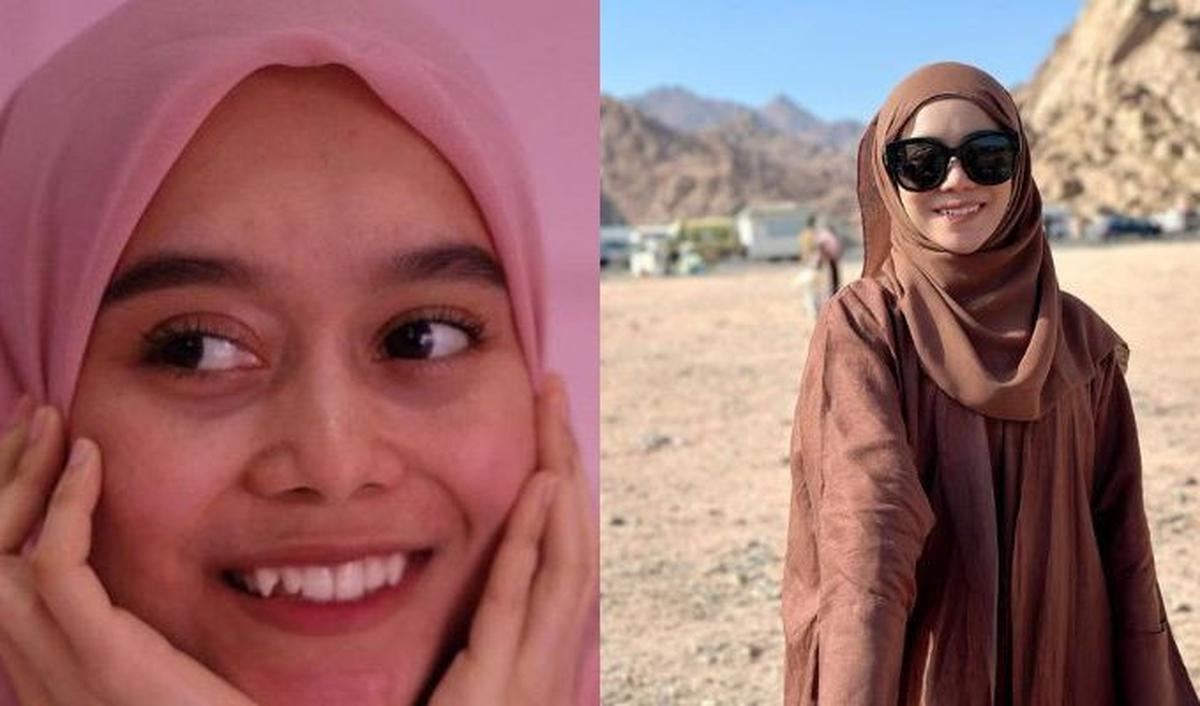 Lesti Kejora juga memutuskan untuk menghilangkan gigi gingsulnya dengan menggunakan behel agar struktur giginya lebih rapi.&nbsp;