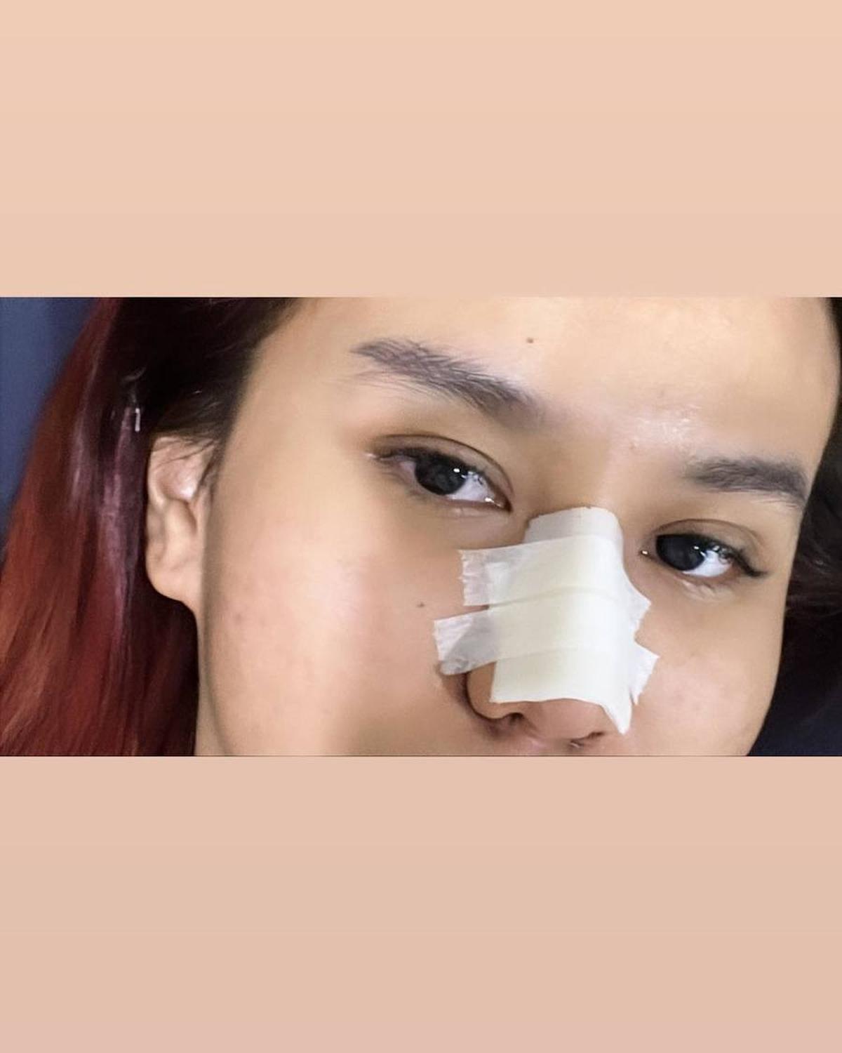 Kini Semakin Cantik