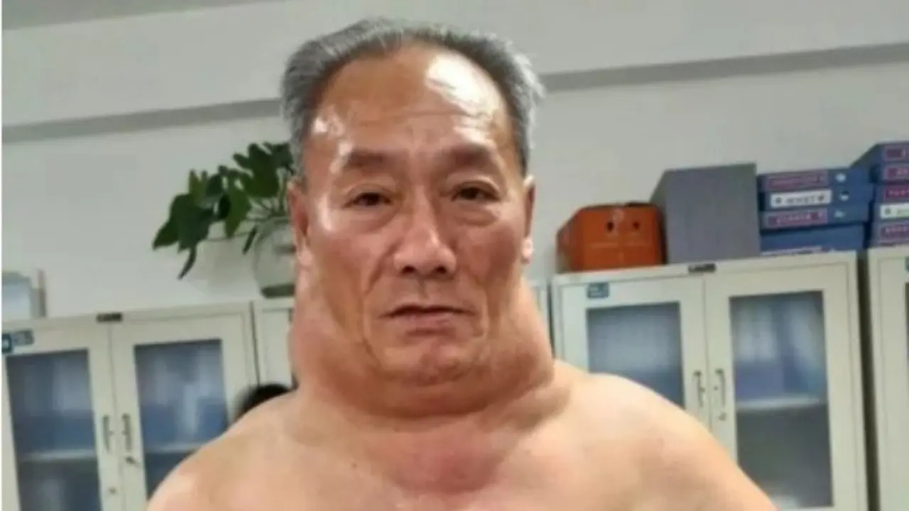 Pria mirip Hulk (Metro.co.uk)