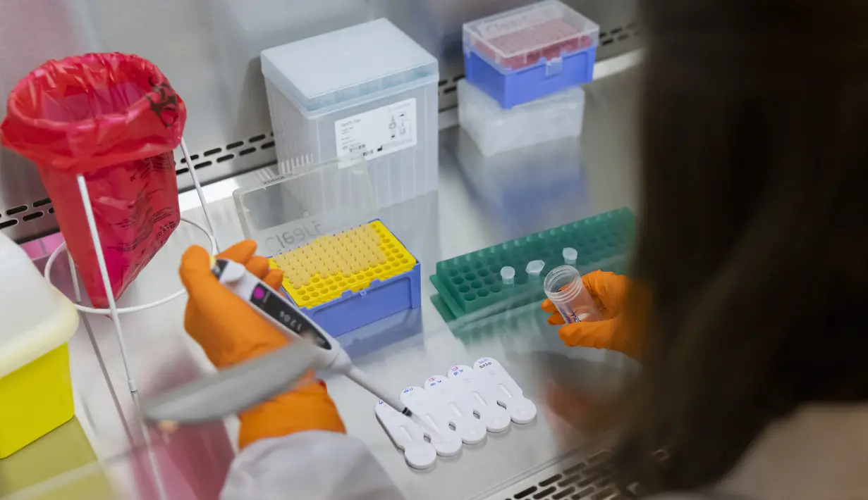 Seorang karyawan bekerja di NG Biotech, start-up yang membuat berbagai tes medis, termasuk kit COVID-19, di Guipry, Prancis pada 7 Januari 2022. Prancis memecahkan rekor infeksi harian tertinggi di Eropa membuat produsen bekerja keras memenuhi permintaan besar untuk tes. (AP Photo/Jeremias Gonzalez)