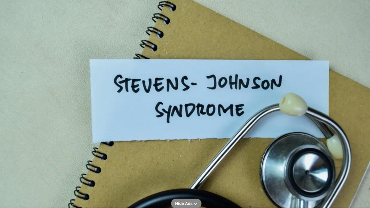 Steven Johnson Syndrome: Panduan untuk Pasien dan Keluarga dalam Proses Diagnosa