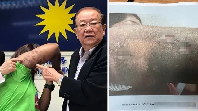 perawatan kecantikan gagal