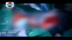 Tim dokter RSUD Dr Soetomo berhasil memisahkan bayi kembar siam Aqila dan Azila asal Kendari, Sulawesi Tenggara pada Rabu, 14 Agustus 2019.