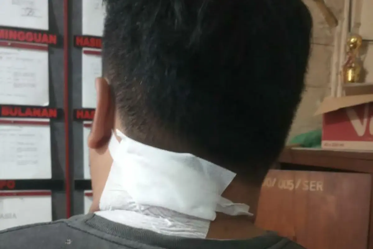 Leher Korban Diperban (Liputan6.com/Ahmad Adirin)