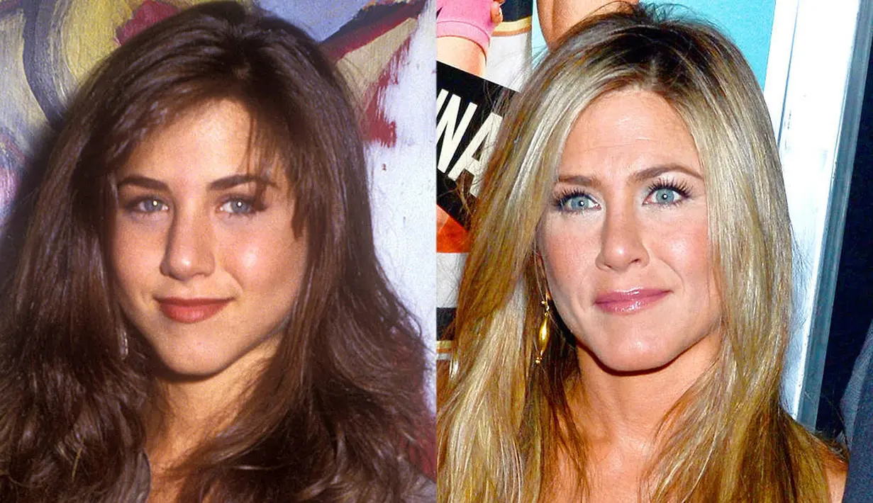 Jennifer Aniston mengaku sudah melakukan operasi hidung pada tahun 2007. (E! Online)