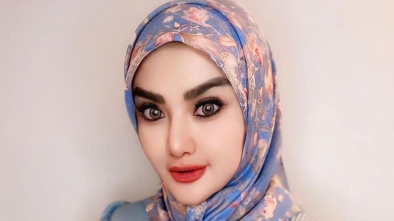 Penampilannya Kini Sudah Berubah Total
