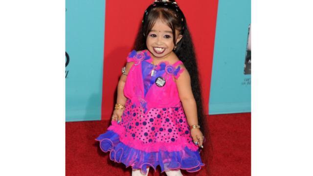 Terpendek hingga Paling Fleksibel, 6 Wanita Ini Masuk Buku Rekor Dunia