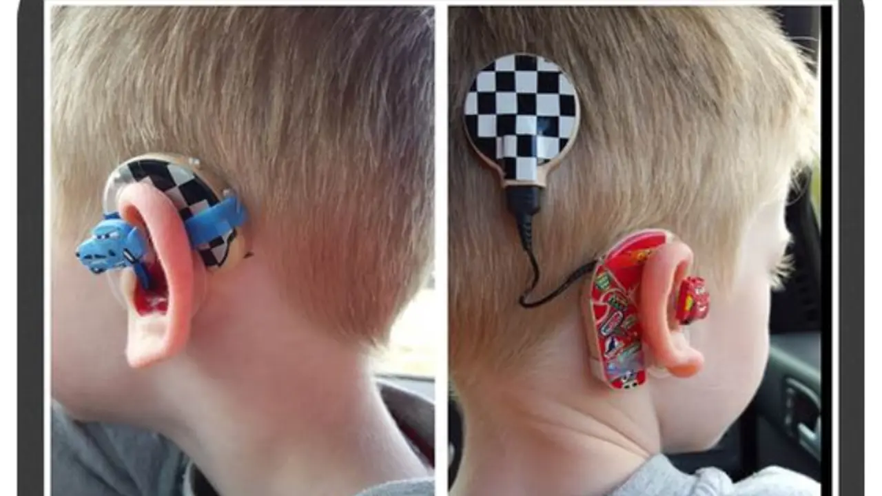 Desain Keren pada Alat Bantu Dengar Anak-Anak