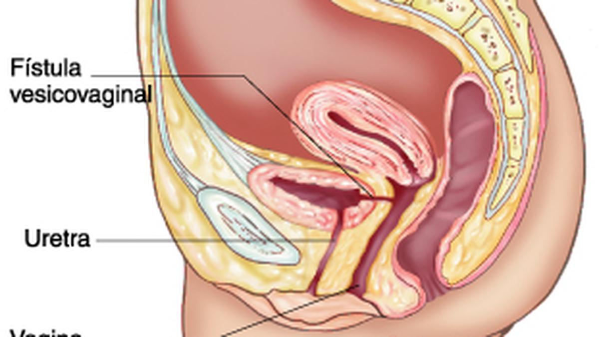 Soxta qin külotlari harakatda