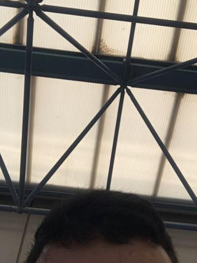 Pria Ini hanya Unggah Foto Dahi di Instagram Selama 6 Tahun