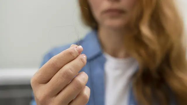 Berbagai treatment atasi rambut rontok