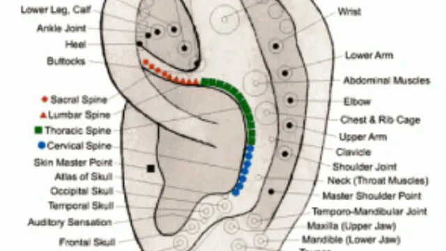 [Bintang] Akupunktur Telinga