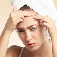 Ilustrasi Menyentuh Jerawat Credit: pexels.com/David