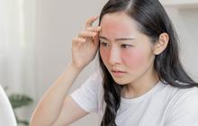 Simak dan Ikuti! Ini 3 Tips Mudah Menenangkan Kulit Terbakar Akibat Paparan Sinar Matahari