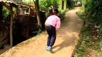 Kisah Pilu Balita 5 Tahun di Sukabumi, Jalan Bungkuk Diduga Idap TB Tulang Tak Mampu Berobat