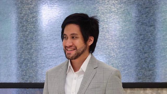 Kenali Risiko Tanam Rambut Seperti yang Dilakukan Kevin Aprilio