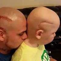 Demi meningkatkan kepercayaan diri sang anak, pria ini bikin tato luka seperti anaknya yang menderita kanker. (Via: boredpanda.com)