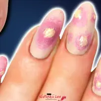 Nail art bentuk jerawat. (Instagram/natashaleeblogger)