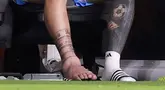 Kaki Lionel Messi tampak bengkak saat pertandingan final Copa America 2024 melawan Kolombia. (AFP/Carmen Mandato)