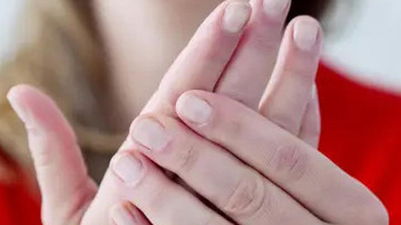 Kenali Gejala Kolesterol Tinggi dari Tanda Tak Biasa di Tangan