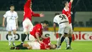 Pemain Hungaria, Miklos Feher terjatuh di tengah pertandingan ketika Benfica melawan Vitoria Guimaraes tahun 2004. Tim medis segera menandunya ke luar lapangan untuk dilarikan ke rumah sakit. Dokter mencoba menolongnya sekitar 90 menit sebelum dirinya dinyatakan meninggal. (Foto: AFP/Luis Vieira)