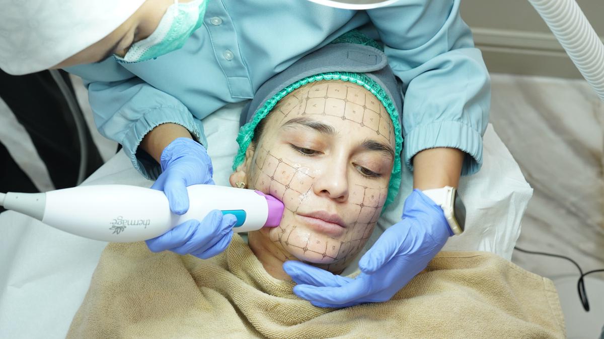Bocoran Perawatan Luna Maya dan Maxime Bouttier Jelang Pernikahan, Lifting hingga Laser