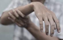 Mengenal Tardive Dyskinesia, Efek Samping Obat yang Sebabkan Gerakan Tak Terkendali