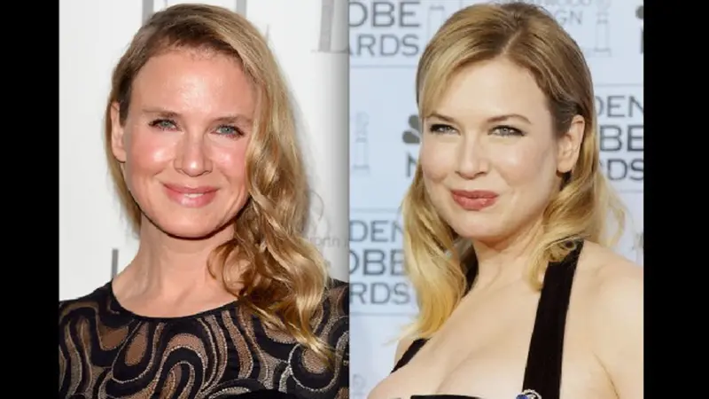 Renee Zellweger sekarang dan dulu.