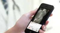 'Instagram' Khusus Dokter, Aplikasi Berbagi Misteri Medis